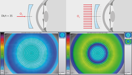 Visualisation de la perméabilité à l'oxygène des lentilles de contact souples